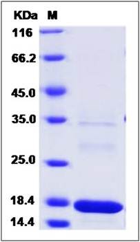 SDS-PAGE analysis of MAGOH (His Tag) protein