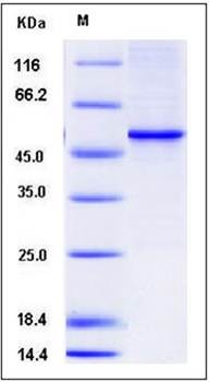 SDS-PAGE analysis of Human VDR protein (His Tag)