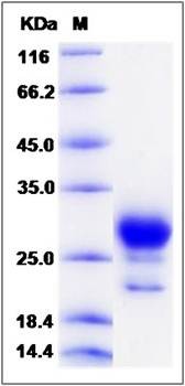SDS-PAGE analysis of Human PTGDS protein (His Tag)