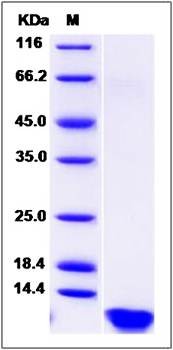 SDS-PAGE analysis of Human INS protein (Native)