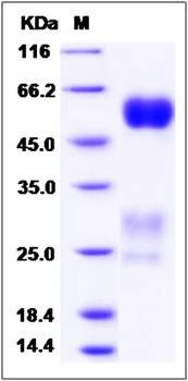 SDS-PAGE analysis of rat GGT1 protein (His Tag)
