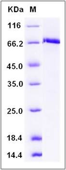 SDS-PAGE analysis of human c-MET protein (GST Tag)