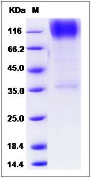 SDS-PAGE analysis of human B3GNT2 protein