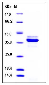 SDS-PAGE analysis of mouse CTSL His tag protein