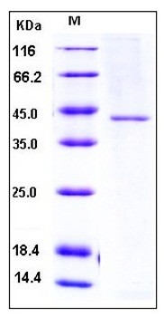 SDS-PAGE analysis of human TCN2 His tag protein
