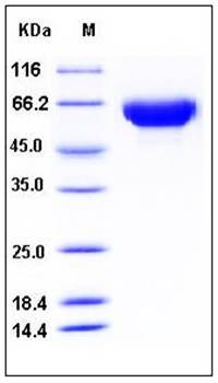 SDS-PAGE analysis of Human HSP12A His tag protein