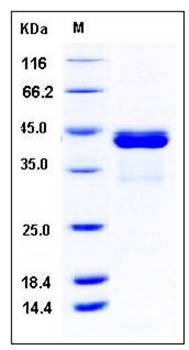 SDS-PAGE analysis of human CALML5 His GST tag protein