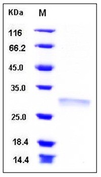 SDS-PAGE analysis of Human RPE His tag protein