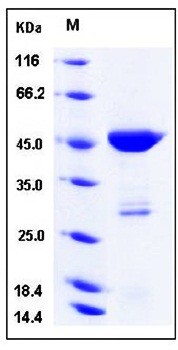 SDS-PAGE analysis of Human PGD His tag protein
