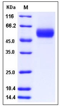 SDS-PAGE analysis of Human SerpinA12 His tag protein
