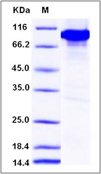SDS-PAGE analysis of mouse CAMK4 protein (GST Tag)