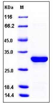 SDS-PAGE analysis of human CASP14 His tag protein