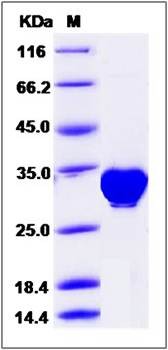 SDS-PAGE analysis of Human PLS3 protein (His Tag)