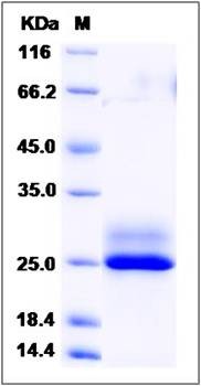 SDS-PAGE analysis of human FKBP14 protein (His Tag)
