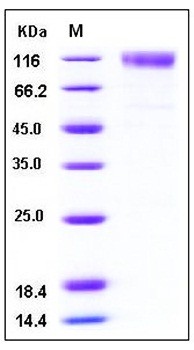 SDS-PAGE analysis of Mouse SCARB1 Fc His tag protein