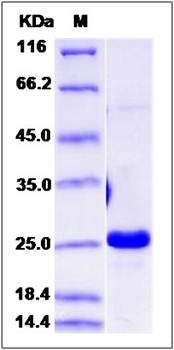 SDS-PAGE analysis of Human IFNA8 protein