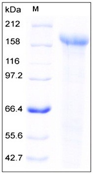 SDS-PAGE analysis of Human JAG1 His tag protein