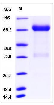 SDS-PAGE analysis of Human KIR2DL1 protein