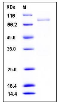 SDS-PAGE analysis of human BLK GST tag protein