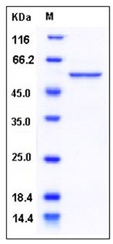 SDS-PAGE analysis of Human RBBP4 His tag protein