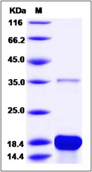 SDS-PAGE analysis of human DBI protein (His Tag)