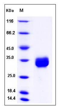 SDS-PAGE analysis of human CCDC134 protein (His Tag)