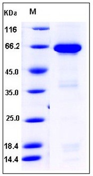 SDS-PAGE analysis of Human IGFBP7 Fc tag protein