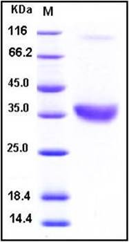 SDS-PAGE analysis of human ACP5 His tag protein