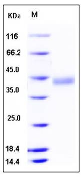 SDS-PAGE analysis of Human IL2RG protein (His Tag)