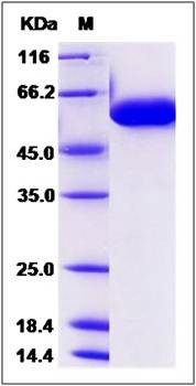 SDS-PAGE analysis of human FUCA1 protein (His Tag)