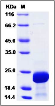 SDS-PAGE analysis of STMN1 (His Tag) protein