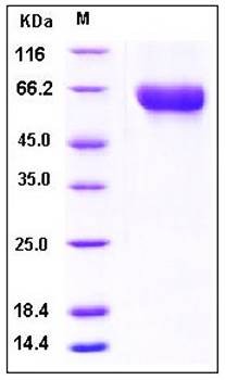 SDS-PAGE analysis of human CNDP1 His tag protein
