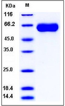 SDS-PAGE analysis of Human MGAT5 His tag protein