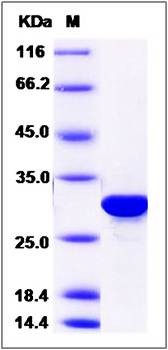 SDS-PAGE analysis of human BPHL protein (His Tag)