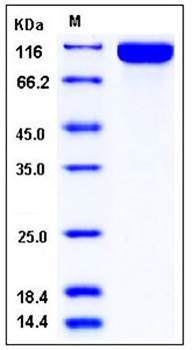 SDS-PAGE analysis of Human DPP10 His tag protein