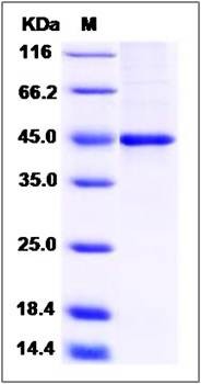 SDS-PAGE analysis of Human PDHA1 protein
