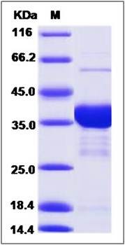 SDS-PAGE analysis of human AKR1C4 protein (His Tag)