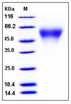 SDS-PAGE analysis of mouse CES5 His tag protein