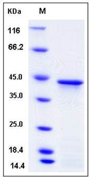 SDS-PAGE analysis of Human HOXA1 protein (His Tag)