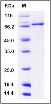 SDS-PAGE analysis of human DDR1 protein (GST Tag)