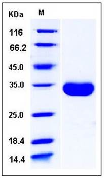 SDS-PAGE analysis of human EPOR His tag protein