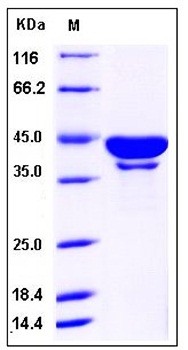 SDS-PAGE analysis of human SerpinB6 His tag protein