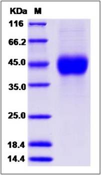 SDS-PAGE analysis of human ATP1B1 protein (His Tag)