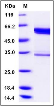 SDS-PAGE analysis of mouse tPA protein