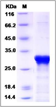 SDS-PAGE analysis of human SMNDC1 protein (His Tag)