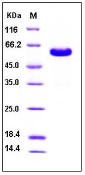 SDS-PAGE analysis of Human CD40 Fc His tag protein