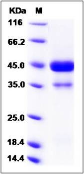 SDS-PAGE analysis of Rat VEGF-C protein