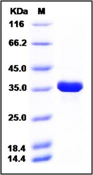 SDS-PAGE analysis of human AKR1B1 His tag protein