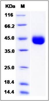 SDS-PAGE analysis of Human IZUMO1 protein (His Tag)
