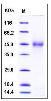 SDS-PAGE analysis of human SFTPD His tag protein